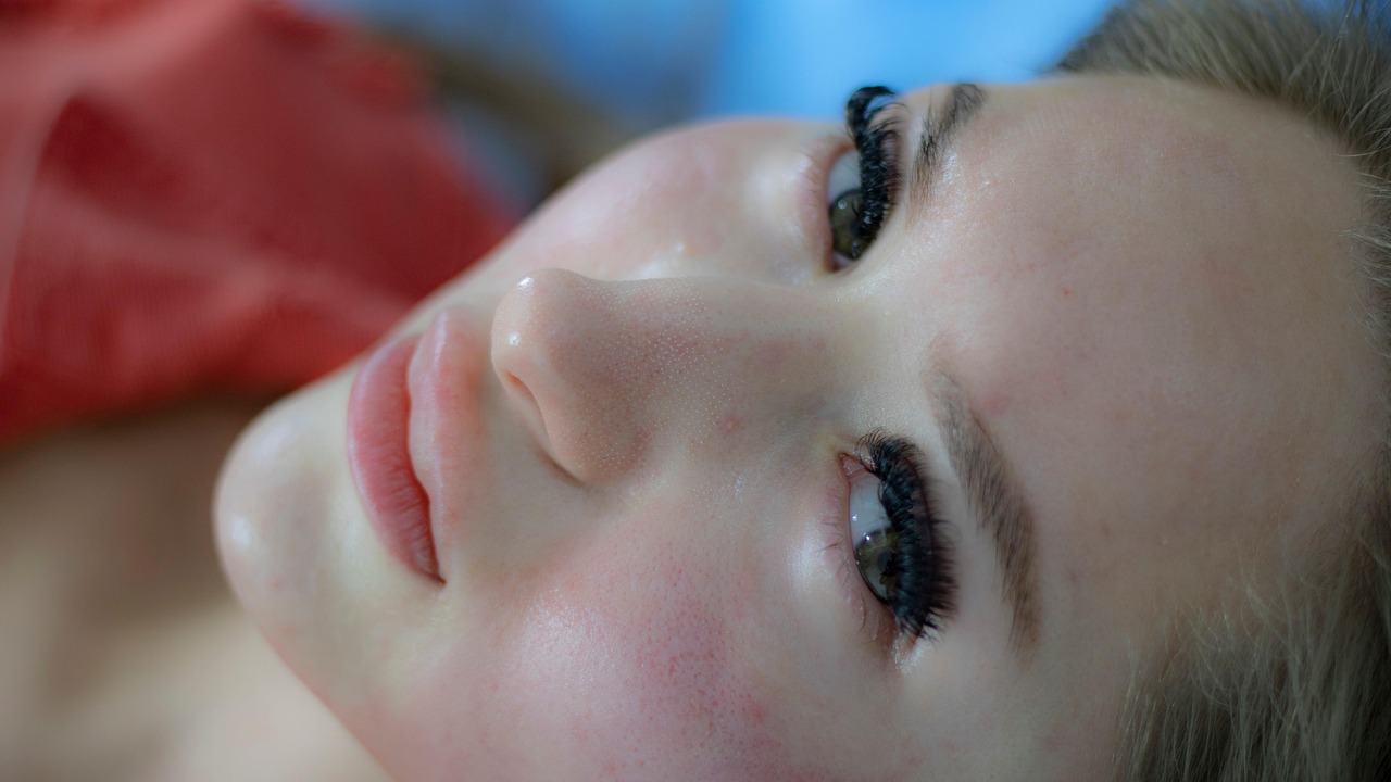 Acne and blemish care